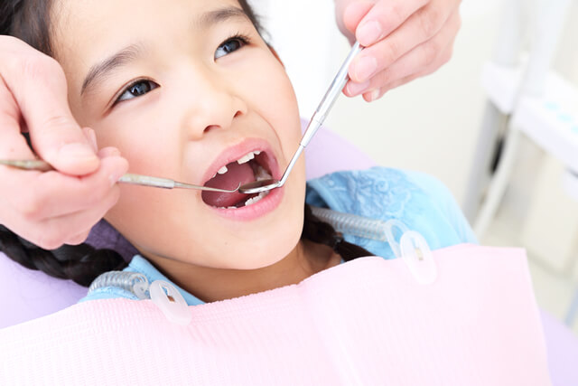 虫歯治療